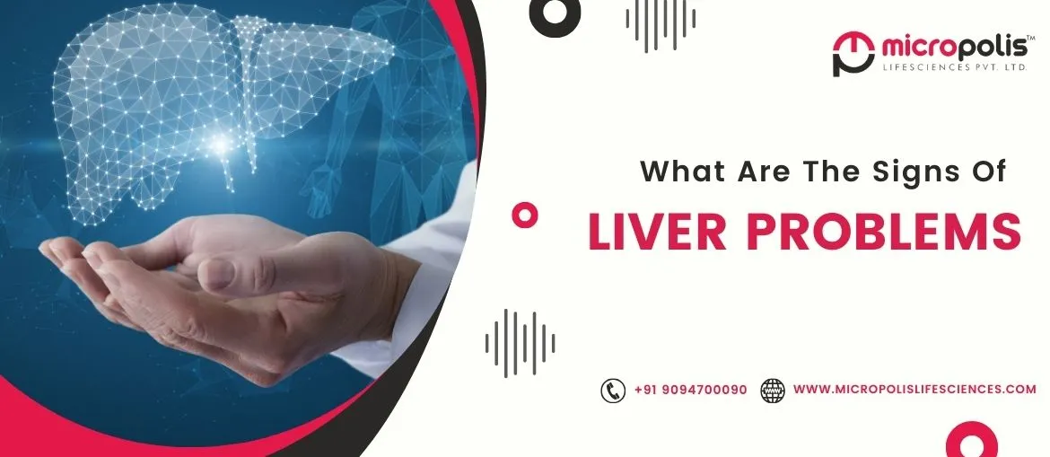 What Are The Signs Of Liver Problems